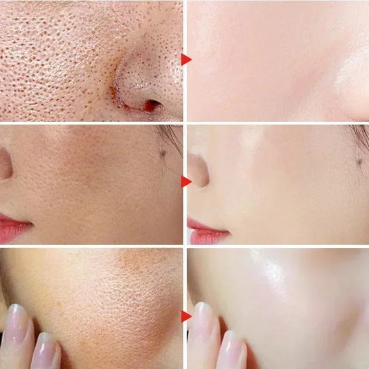 Suero para eliminar poros dilatados, ácido láctico, productos faciales que reducen los poros, reparan y reafirman, suavizan y minimizan los poros, cuidado de la piel coreano.
