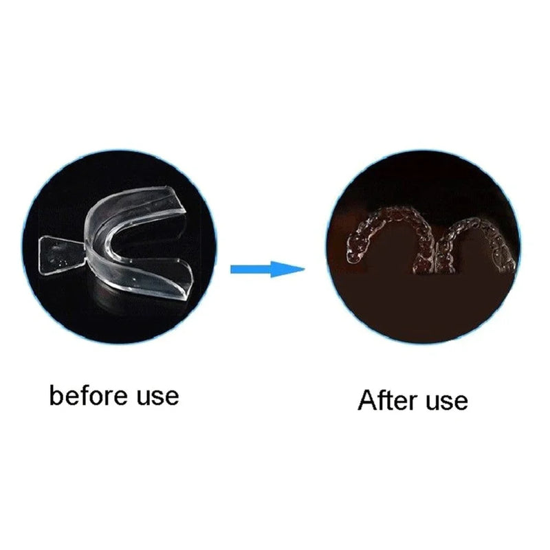 2-8pcs Anti Snoring Bruxism Sleeping Mouth Guard Tray Stop Teeth Grinding Sleep Aid Night Guard Gum Shield Mouth Health Care 