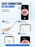 Smart Visual Ear Wax Remover with 1080P HD Camera, USB C Rechargeable Ear Cleaner, Waterproof Ear Scope Otoscope, Safe Ear Wax R