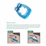 Anti Snoring Devices Men And Women Creative Sleeping Aid Improve Sleeping Magnetic Anti Snoring Nose Clip Forward To Open Airway