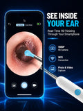 Smart Visual Ear Wax Remover with 1080P HD Camera, USB C Rechargeable Ear Cleaner, Waterproof Ear Scope Otoscope, Safe Ear Wax R