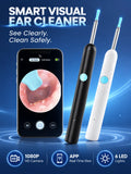 Smart Visual Ear Wax Remover with 1080P HD Camera, USB C Rechargeable Ear Cleaner, Waterproof Ear Scope Otoscope, Safe Ear Wax R