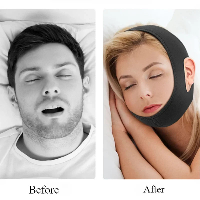 Anti Snore Belt for Men and Women, Stop Snoring Chin Strap, Night Sleep Support, Jaw Bandage, Snore Guard, Health Tools 