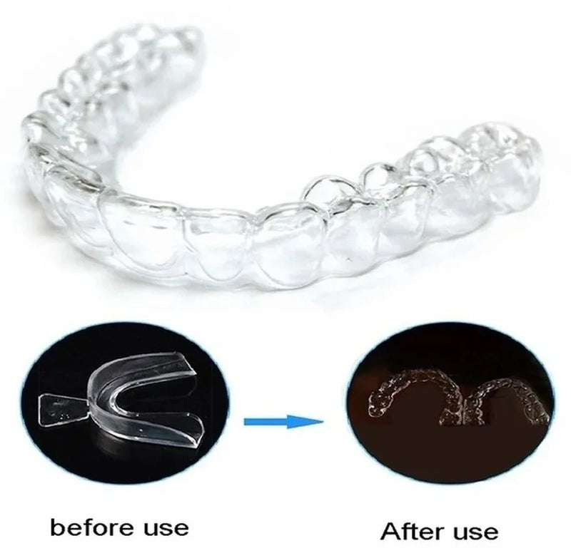 Anti Snoring Bruxism Sleep Mouth Guard, Gum Night Guard, Mouth Tray, Stop Teeth Grinding, Sleep Aid, Health Care 