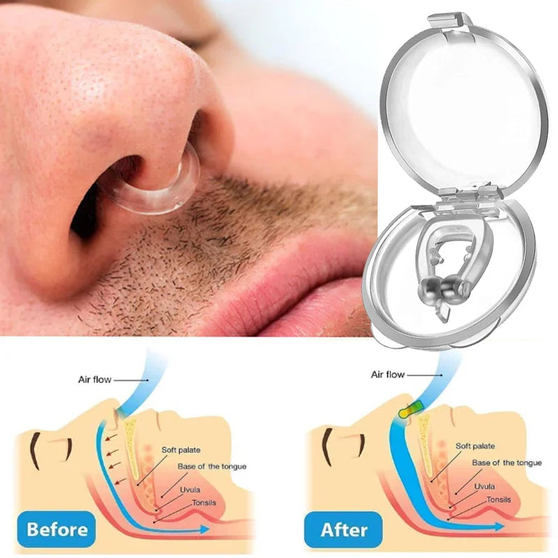 Dispositivo antirronquidos para mujeres, pinza nasal para eliminar ronquidos, pinza nasal para hombres, sueño nocturno 