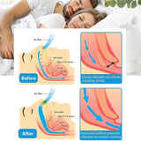 Dispositivo antirronquidos para mujeres, pinza nasal para eliminar ronquidos, pinza nasal para hombres, sueño nocturno 