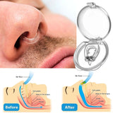 Dispositivo antirronquidos para mujeres, pinza nasal para eliminar ronquidos, pinza nasal para hombres, sueño nocturno 