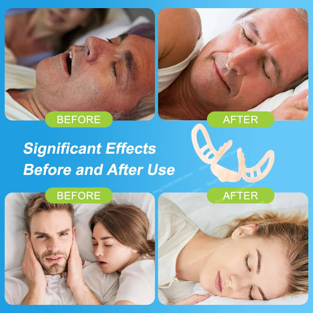 Anti Snoring Nasal Dilator, Stop Snoring Silicone Nose Clip, Sport Easy Breath Nasal Clip, Snoring Aid Device, Improve Sleep 
