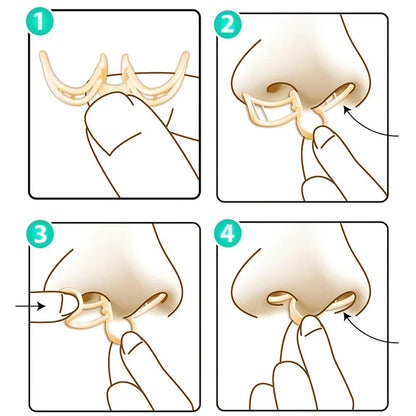 Dilatador nasal para reducir los ronquidos, antirronquidos, aumenta el flujo de aire, dispositivos antirronquidos, pinza nasal de silicona, mejora el sueño y los ronquidos. 