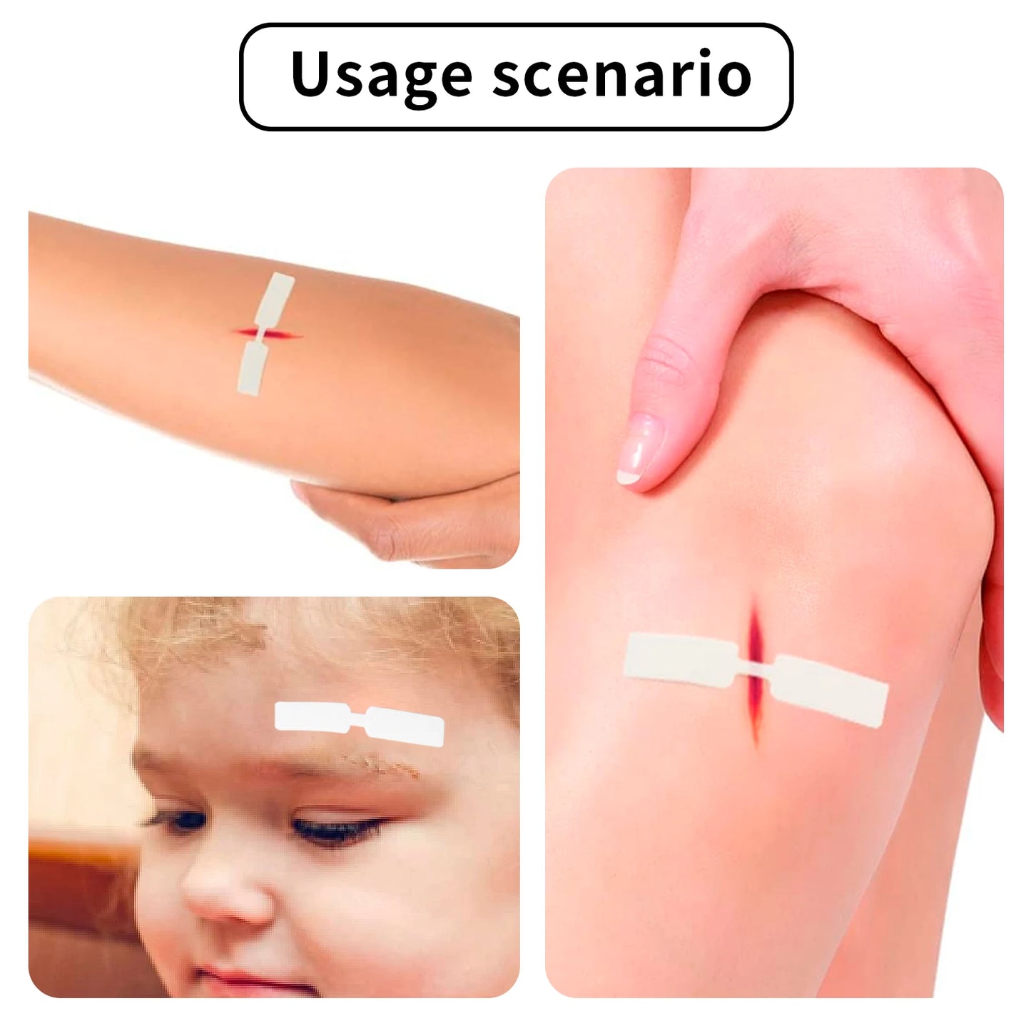 Small Waterproof Band Aid, Butterfly Adhesive, Wound Closure, Emergency Kit, Bandages, Hot Sale, 1cm x 4.5cm, 120pcs 