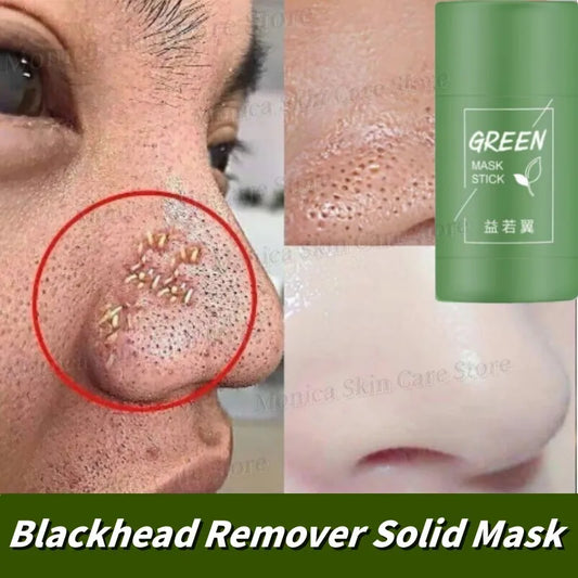 Mascarilla de barro con té verde original para eliminar puntos negros y acné, reduce los poros, crema para el acné, tratamiento de espinillas, cuidado coreano para la piel limpia.
