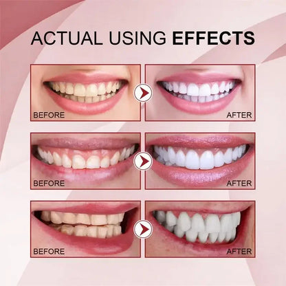 SP-10 Probiotic Toothpaste Whiten Tooth Remove Plaque Stains Teeth Whitener Oral Hygiene Clean Fresh Breath Teeth Care Product