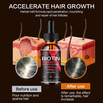 Suero de biotina para el crecimiento del cabello, productos anticaída, crecimiento rápido, previene el frizz, tratamiento reparador para cabello dañado, spray para el cuidado de la barba y el cuero cabelludo.