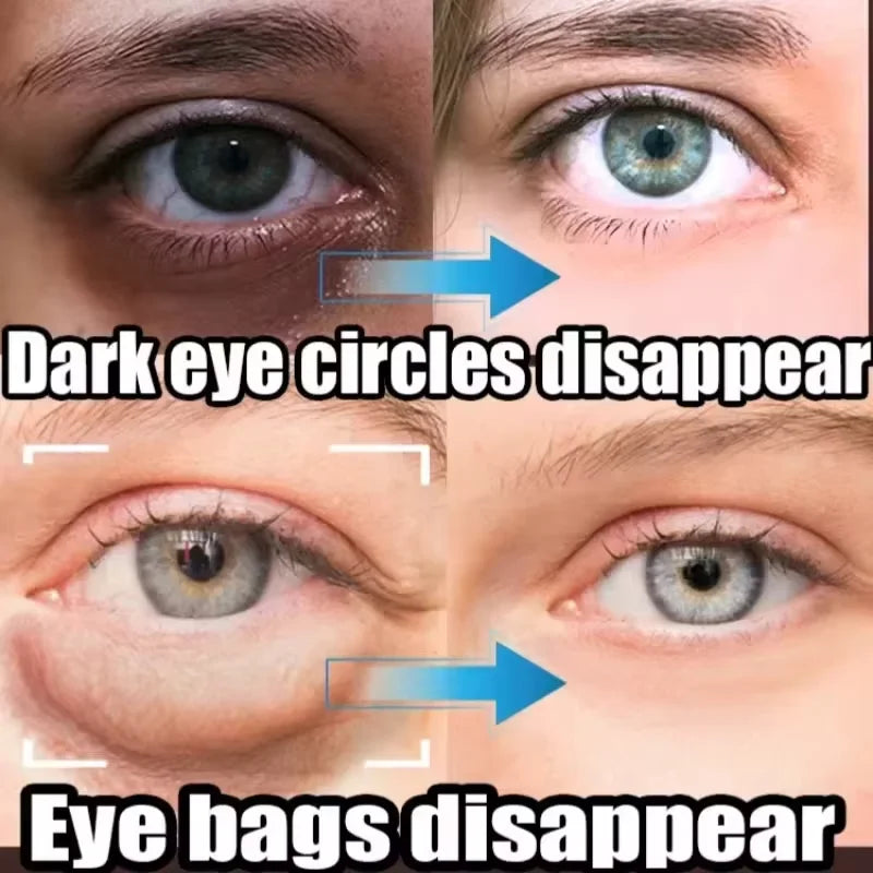 Suero de ojos antiojeras con retinol, antiarrugas, reafirmante, elimina bolsas, atenúa líneas finas, blanquea e ilumina. Cuidado de ojos coreano.