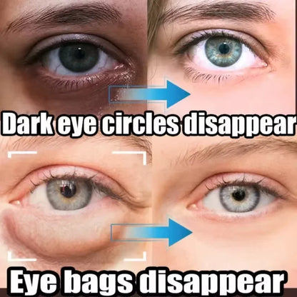 Suero de ojos antiojeras con retinol, antiarrugas, reafirmante, elimina bolsas, atenúa líneas finas, blanquea e ilumina. Cuidado de ojos coreano.