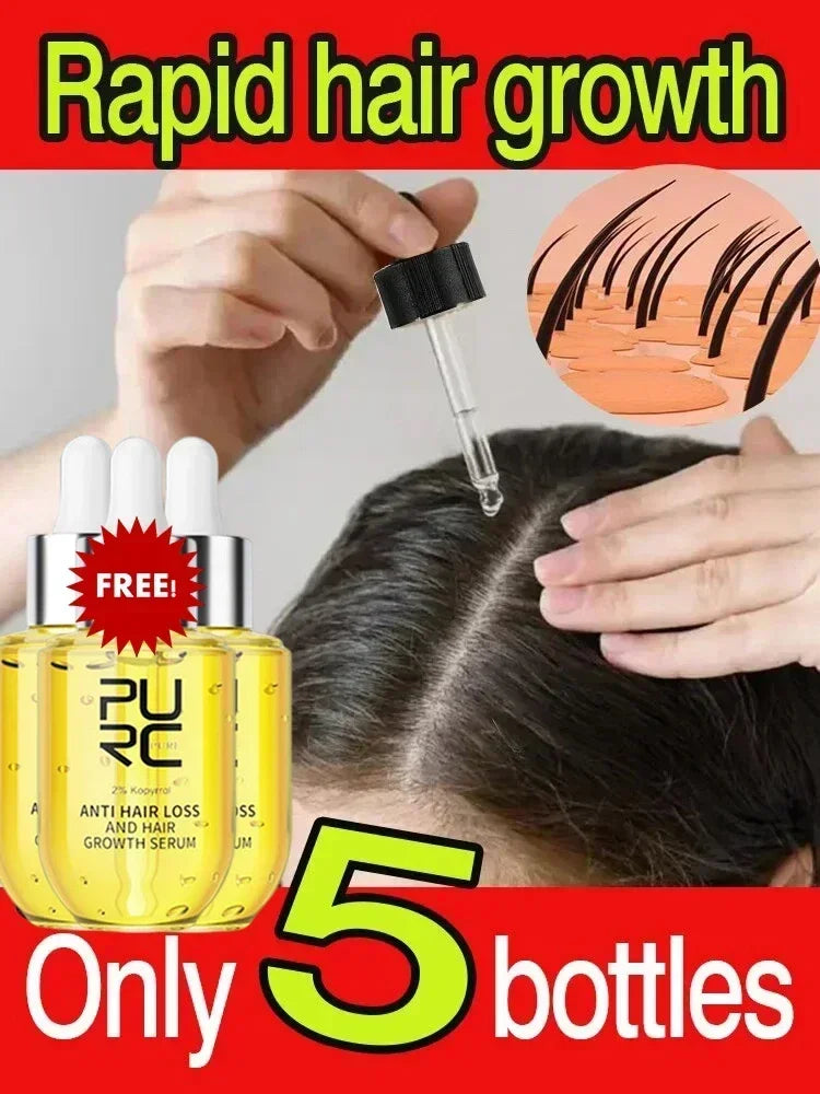 Fast Hair Growth for Men and Women, Ginger Hair Growth Oil, Hair Care, Anti-Hair Loss Treatment, Scalp Serum, Beauty and Health Products