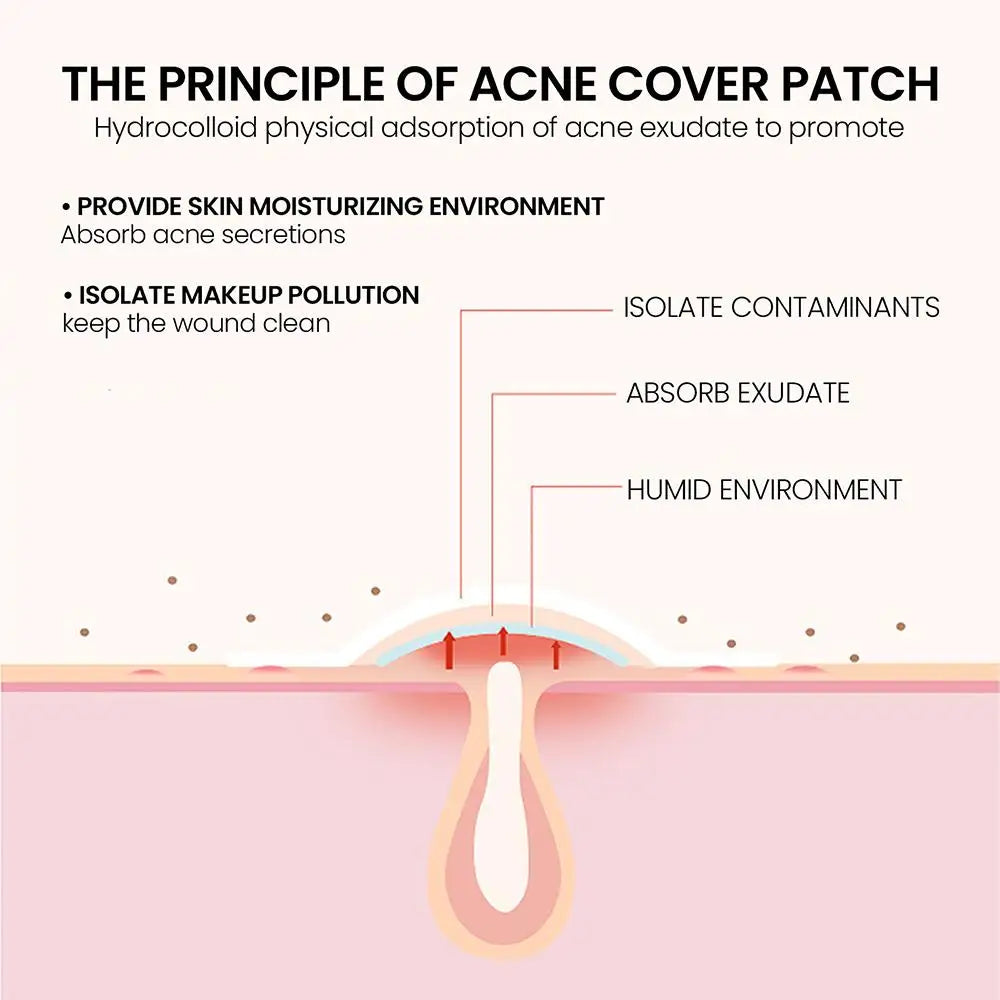 200pcs Colorful Star-Shaped Hydrocolloid Invisible Pimple Patches For Face, Cute Zit Cover Stickers Skin Care