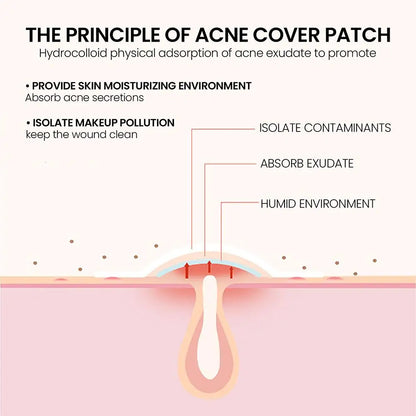 200pcs Colorful Star-Shaped Hydrocolloid Invisible Pimple Patches For Face, Cute Zit Cover Stickers Skin Care