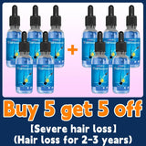 Este é absolutamente o produto para crescimento capilar mais eficaz do século XXI, que ajudou milhões de pessoas a se livrar da queda de cabelo e da calvície, 100% eficaz.