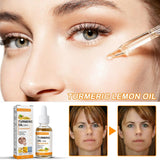 Turmeric Oil Skin Glow To Lightening Acne Dark Patches Acne Bright Skin Dark Spot Corrector Face Whitening Serum product
