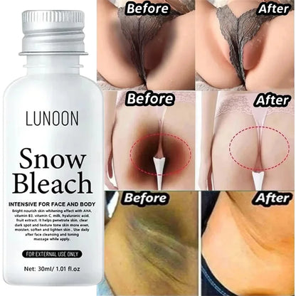 Crema blanqueadora para partes íntimas, suero blanqueador de axilas, blanquea glúteos y rodillas, aclara la parte interna del muslo, oscurece las partes íntimas y elimina la melanina.