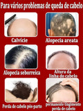 Este é absolutamente o produto para crescimento capilar mais eficaz do século XXI, que ajudou milhões de pessoas a se livrar da queda de cabelo e da calvície, 100% eficaz.