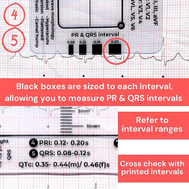 ECG 7 Step Ruler, Ruler Card for ECG/EKG Interpretation, Portable Pocket ECG EKG Reference Guide with Sheath, Emergency tool
