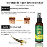 Ginger Hair Growth Serum Sprayer Fast Hair Growth Dense Regrowth Ginger Serum Oil Natural Hair Growth Accelerator For Stronger