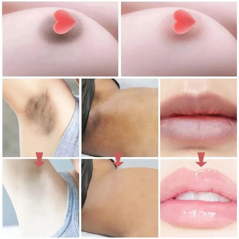 Body Whitening Cream For Dark Skin Intimate Area Pink Essence Dullness Brighten Skin Whitener Beauty Health For Dropshipping 20g