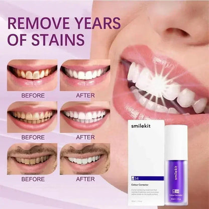 Pasta dental blanqueadora morada V34 de 30 ml. Elimina manchas, reduce el amarilleo y cuida tus dientes, encías, aliento fresco y blanquea los dientes.