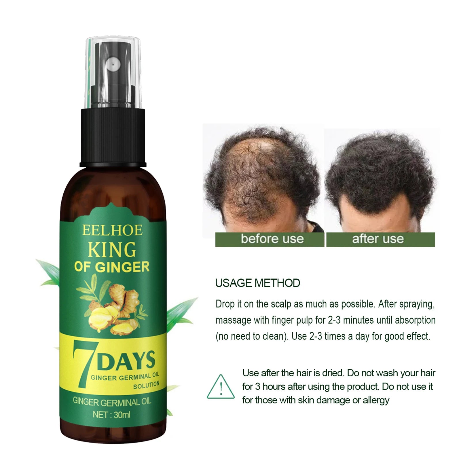 Ginger Hair Growth Serum Sprayer Fast Hair Growth Dense Regrowth Ginger Serum Oil Natural Hair Growth Accelerator For Stronger