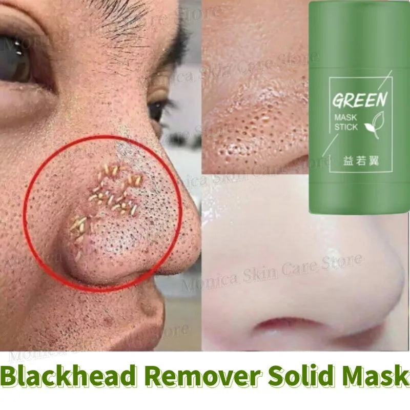 Original Green Tea Deep Remove Blackheads Acne Mud Mask Stick Shrink Pores Dispel Acne Cream Treat Pimple Korean Clean Skin Care