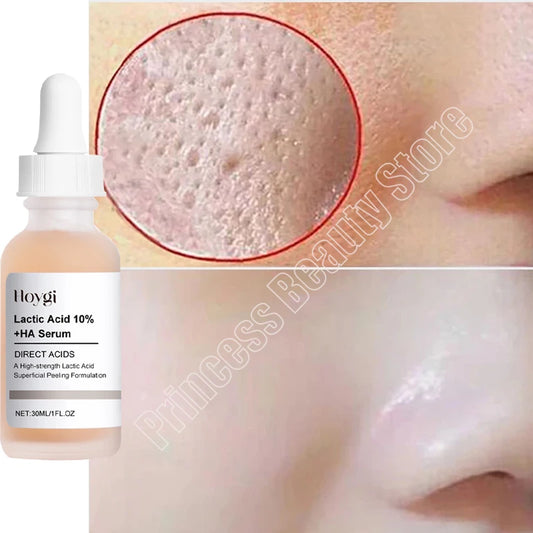Suero para eliminar poros dilatados, ácido láctico, productos faciales que reducen los poros, reparan y reafirman, suavizan y minimizan los poros, cuidado de la piel coreano.