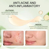 30pcs Acne Pimple Patches Invisible Removal Pimple Anti-Acne Hydrocolloid Patches Spots Mark Concealer Waterproof Repair Sticker