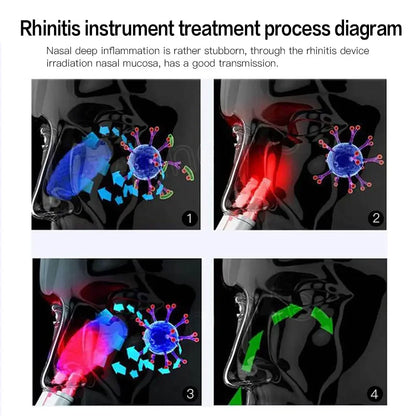 Rhinitis Relief Instrument Sinusitis Therapy Massage Machine Hay fever Low Frequency Pulse Laser Pen Nose Treatment Health Care