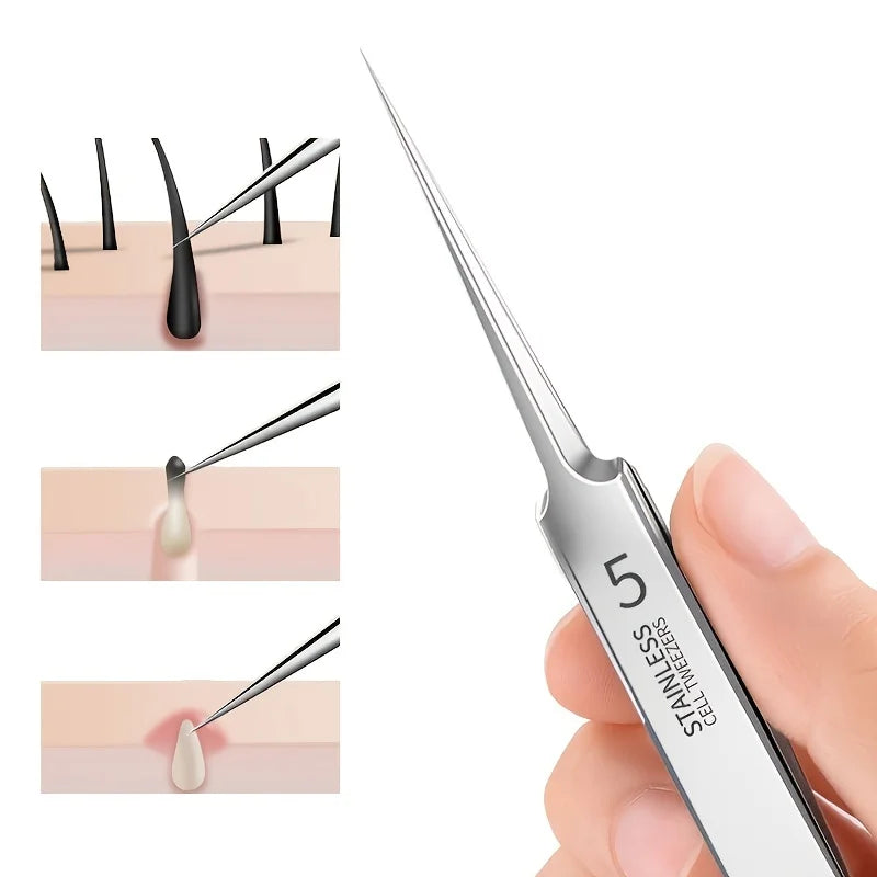 Pinzas extrafinas n.° 5 para puntos negros y acné - Herramientas de belleza facial para eliminar el acné y el cuidado de la piel