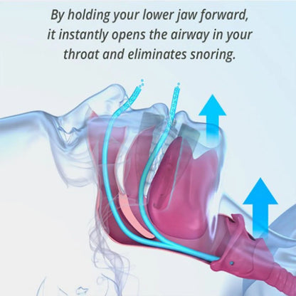 Anti-Snore Tongue Retaining Device Reusable Anti Snoring Mouthpiece Braces Snoring Stopper n Women Night's Sleep