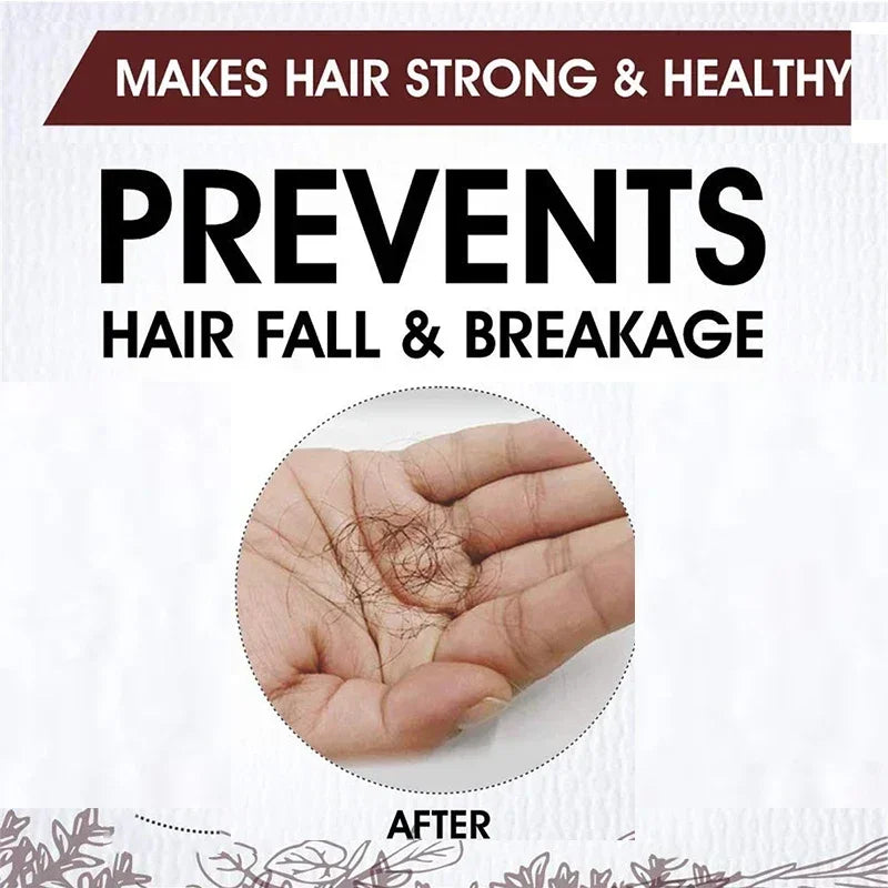 Fast Hair Growth for Men and Women, Ginger Hair Growth Oil, Hair Care, Anti-Hair Loss Treatment, Scalp Serum, Beauty and Health Products