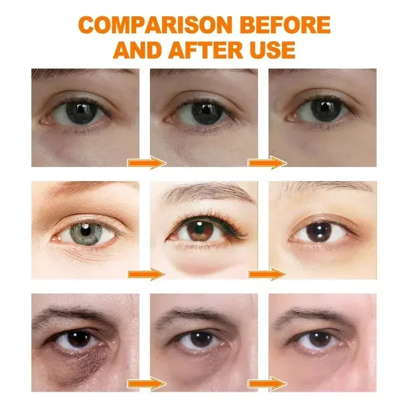 Suero de ojos antiojeras con retinol, antiarrugas, reafirmante, elimina bolsas, atenúa líneas finas, blanquea e ilumina. Cuidado de ojos coreano.