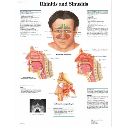 Rhinitis Relief Instrument Sinusitis Therapy Massage Machine Hay fever Low Frequency Pulse Laser Pen Nose Treatment Health Care