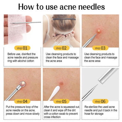 1PC Acne Clip Set Cell Clip Acne Needle Squeezing Blackhead Pressing Rod Cleaning Facial Stainless Steel Beauty Tool