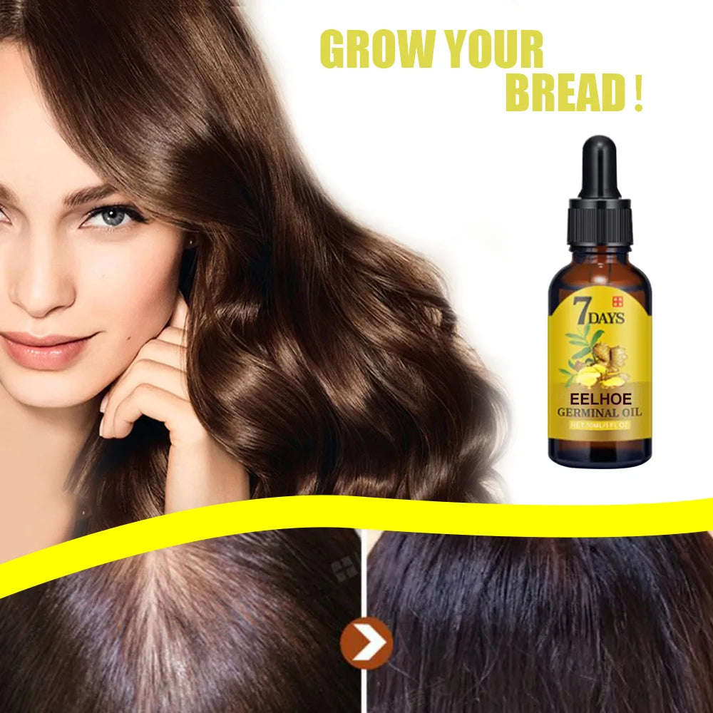 EELHOE Ginger Hair Growth Oil for Hair Growth, Anti-Hair Loss Treatment, Natural Essence, Moisturizing Growth, Nutrient Solution, Care Products