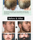 The most effective beard growth essence in 2025, grow a thick beard in 7 days. Chest hair, leg hair, beard and hair growth