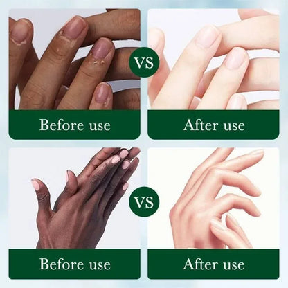 Clareamento Dark Knuckles Cream, Ilumine o creme de mãos Clarear Dull Corrector, Removedor de manchas hidratantes, Cuidados com a pele coreana