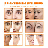 Turmeric Oil Skin Glow To Lightening Acne Dark Patches Acne Bright Skin Dark Spot Corrector Face Whitening Serum product