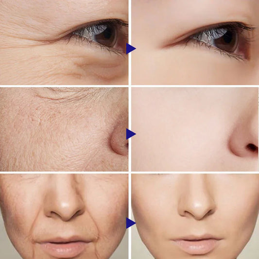 Crema facial antiarrugas con retinol, reafirmante, lifting, antiedad, atenúa líneas finas, hidratante, blanqueadora, reparadora, cuidado de la piel, cosmética.
