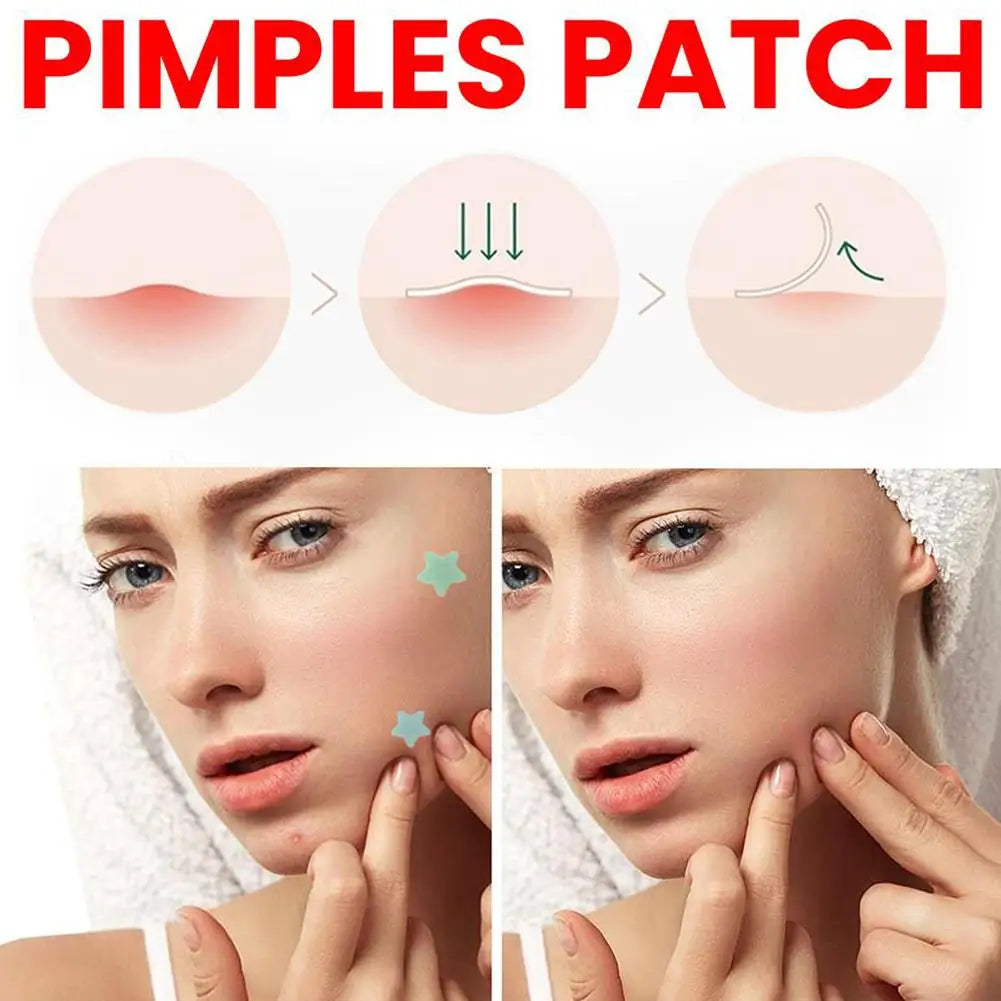 216PCS Pimple Patch Acne Colorful Invisible Acne Removal Skin Care Stickers Concealer Face Spot Beauty Makeup Tools
