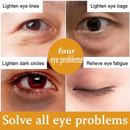Suero de ojos antiojeras con retinol, antiarrugas, reafirmante, elimina bolsas, atenúa líneas finas, blanquea e ilumina. Cuidado de ojos coreano.