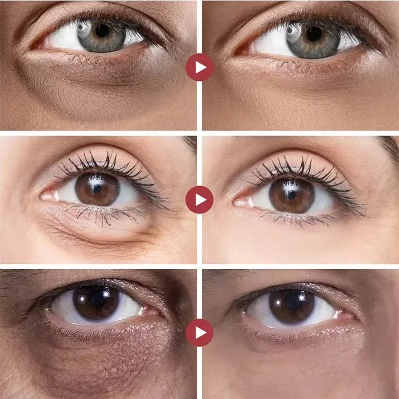 Suero de ojos antiojeras con retinol, antiarrugas, reafirmante, elimina bolsas, atenúa líneas finas, blanquea e ilumina. Cuidado de ojos coreano.