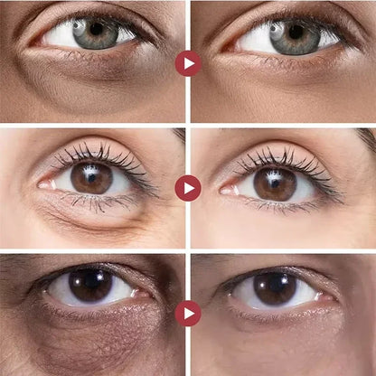 Suero de ojos antiojeras con retinol, antiarrugas, reafirmante, elimina bolsas, atenúa líneas finas, blanquea e ilumina. Cuidado de ojos coreano.